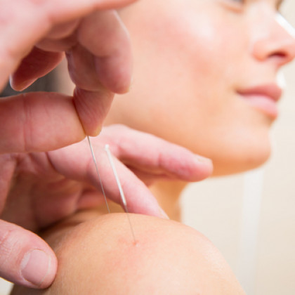 Acupuncture needle placement