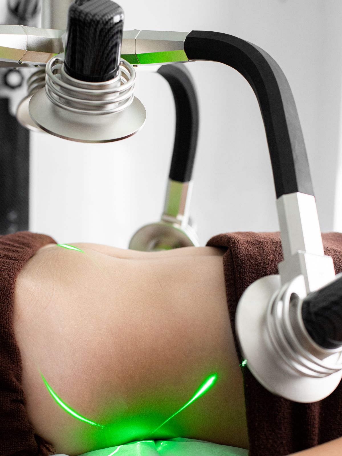 PHYSIQ treatment laser targeting
